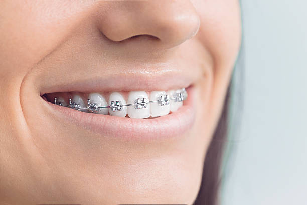 Laser Dentistry in North Lima, OH